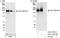 Bromodomain Adjacent To Zinc Finger Domain 1A antibody, A301-318A, Bethyl Labs, Western Blot image 