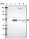 SLC9A3 Regulator 2 antibody, NBP1-84944, Novus Biologicals, Western Blot image 