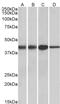 Acetyl-CoA Acetyltransferase 1 antibody, PA5-19226, Invitrogen Antibodies, Western Blot image 
