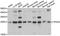 VPS28 Subunit Of ESCRT-I antibody, A9104, ABclonal Technology, Western Blot image 