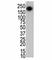Leucine Rich Repeat Kinase 2 antibody, F40409-0.4ML, NSJ Bioreagents, Western Blot image 