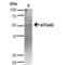 Autophagy Related 4D Cysteine Peptidase antibody, LS-C776179, Lifespan Biosciences, Western Blot image 