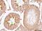 Mechanistic Target Of Rapamycin Kinase antibody, ab2732, Abcam, Immunohistochemistry paraffin image 