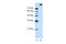 Splicing Factor 3b Subunit 1 antibody, 29-408, ProSci, Western Blot image 