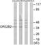 Olfactory Receptor Family 52 Subfamily B Member 2 antibody, TA316272, Origene, Western Blot image 