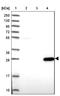 Poly(A) Binding Protein Nuclear 1 Like, Cytoplasmic antibody, NBP1-94055, Novus Biologicals, Western Blot image 