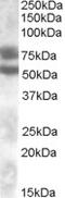 Dachshund Family Transcription Factor 1 antibody, MBS421809, MyBioSource, Western Blot image 