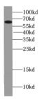 Twinkle protein, mitochondrial antibody, FNab09115, FineTest, Western Blot image 