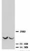 TIMP Metallopeptidase Inhibitor 3 antibody, LS-C171706, Lifespan Biosciences, Western Blot image 