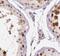 Tgr antibody, FNab09135, FineTest, Immunohistochemistry paraffin image 