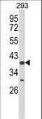 Chondroitin Sulfate N-Acetylgalactosaminyltransferase 2 antibody, LS-C167084, Lifespan Biosciences, Western Blot image 