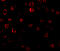 Interleukin 1 Receptor Associated Kinase 1 antibody, 1007, ProSci, Immunofluorescence image 