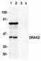 Serine/threonine-protein kinase 17B antibody, TA306007, Origene, Western Blot image 