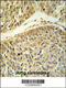 Arginine-Glutamic Acid Dipeptide Repeats antibody, 64-206, ProSci, Immunohistochemistry paraffin image 