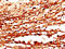 Cystatin A antibody, CSB-PA006099DA01HU, Cusabio, Immunohistochemistry paraffin image 
