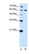 Deltex E3 Ubiquitin Ligase 2 antibody, NBP1-53119, Novus Biologicals, Western Blot image 