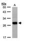 Tetraspanin-1 antibody, GTX108675, GeneTex, Western Blot image 