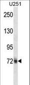 Heterogeneous Nuclear Ribonucleoprotein M antibody, LS-C164961, Lifespan Biosciences, Western Blot image 