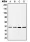 Histone Acetyltransferase 1 antibody, orb214799, Biorbyt, Western Blot image 