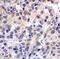 Platelet receptor Gi24 antibody, M32320, Boster Biological Technology, Immunohistochemistry paraffin image 