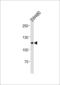 MutS Homolog 2 antibody, LS-C164646, Lifespan Biosciences, Western Blot image 