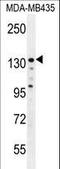 Zinc Finger E-Box Binding Homeobox 2 antibody, LS-C160768, Lifespan Biosciences, Western Blot image 
