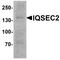 IQ Motif And Sec7 Domain 2 antibody, A09440, Boster Biological Technology, Western Blot image 