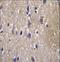 Carboxypeptidase N Subunit 2 antibody, LS-C166995, Lifespan Biosciences, Immunohistochemistry paraffin image 