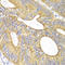 Vascular Endothelial Growth Factor B antibody, LS-C331922, Lifespan Biosciences, Immunohistochemistry paraffin image 