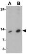 Late Endosomal/Lysosomal Adaptor, MAPK And MTOR Activator 3 antibody, GTX31568, GeneTex, Western Blot image 