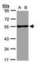 Tubulin Beta 8 Class VIII antibody, GTX109641, GeneTex, Western Blot image 