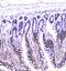 Ubiquitin Conjugating Enzyme E2 I antibody, A02295, Boster Biological Technology, Immunohistochemistry paraffin image 