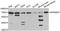 Ribosomal Protein S6 Kinase B1 antibody, A2190, ABclonal Technology, Western Blot image 