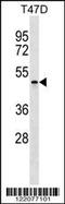 Apolipoprotein B MRNA Editing Enzyme Catalytic Polypeptide Like 4 antibody, 59-582, ProSci, Western Blot image 