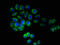 Transmembrane Protein 161B antibody, LS-C396686, Lifespan Biosciences, Immunofluorescence image 