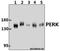 Eukaryotic Translation Initiation Factor 2 Alpha Kinase 3 antibody, GTX66661, GeneTex, Western Blot image 