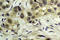 Nibrin antibody, LS-C177938, Lifespan Biosciences, Immunohistochemistry frozen image 