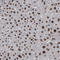 Poly(ADP-Ribose) Polymerase 1 antibody, AMAb90959, Atlas Antibodies, Immunohistochemistry paraffin image 