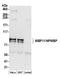 WW Domain Binding Protein 11 antibody, A304-856A, Bethyl Labs, Western Blot image 