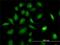 Phosphoribosylglycinamide Formyltransferase, Phosphoribosylglycinamide Synthetase, Phosphoribosylaminoimidazole Synthetase antibody, H00002618-M01, Novus Biologicals, Immunocytochemistry image 