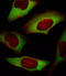 Eukaryotic Translation Initiation Factor 4E antibody, LS-B12932, Lifespan Biosciences, Immunofluorescence image 