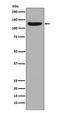 Collagen Type I Alpha 2 Chain antibody, M00624, Boster Biological Technology, Western Blot image 