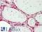 Eukaryotic Translation Initiation Factor 4A3 antibody, LS-B12350, Lifespan Biosciences, Immunohistochemistry paraffin image 