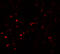 Myocardial Zonula Adherens Protein antibody, A13349, Boster Biological Technology, Immunofluorescence image 