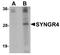 Synaptogyrin 4 antibody, A19415, Boster Biological Technology, Western Blot image 