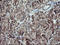 Tumor Protein P73 antibody, LS-C174782, Lifespan Biosciences, Immunohistochemistry paraffin image 