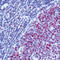 MutS Homolog 2 antibody, LS-C87790, Lifespan Biosciences, Immunohistochemistry paraffin image 