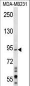 Mitotic Arrest Deficient 1 Like 1 antibody, LS-C163958, Lifespan Biosciences, Western Blot image 