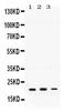 HRas Proto-Oncogene, GTPase antibody, RP1099, Boster Biological Technology, Western Blot image 