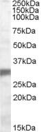 OTU Deubiquitinase, Ubiquitin Aldehyde Binding 2 antibody, 46-882, ProSci, Western Blot image 